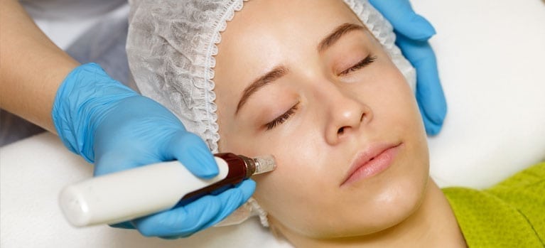 More On Microneedling at New Leaf Wellness